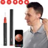 گوش پاک کن دوربین دار برند BEBIRD A2 - Image 8