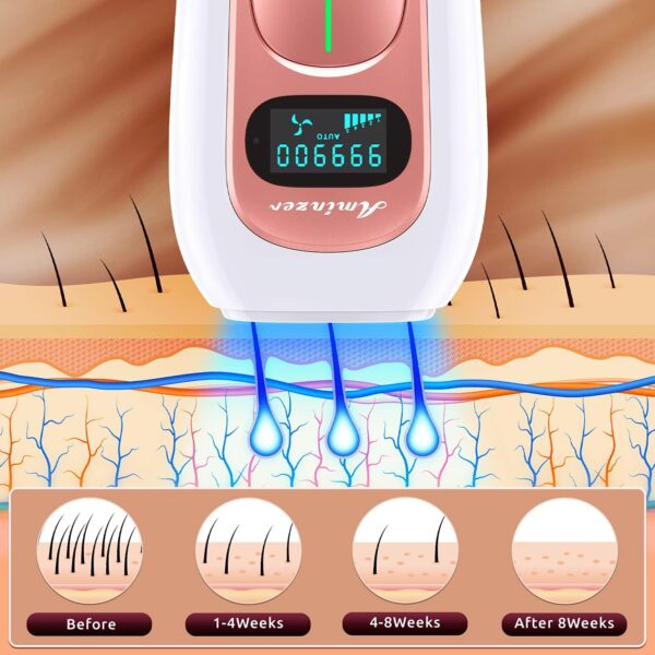 لیزر حذف موهای زائد بدن IPL برند AMINZER مدل PA2 - Image 2