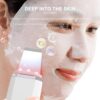 لایه بردار پوست صورت التراسونیک برند ANLAN مدل JD-CP001 - Image 2